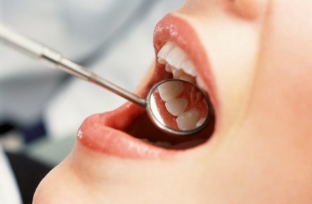 Лечение кариеса зубов. Лечебные гели – новинка стоматологии.